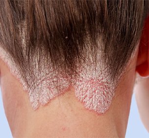 Skin & Hair Care